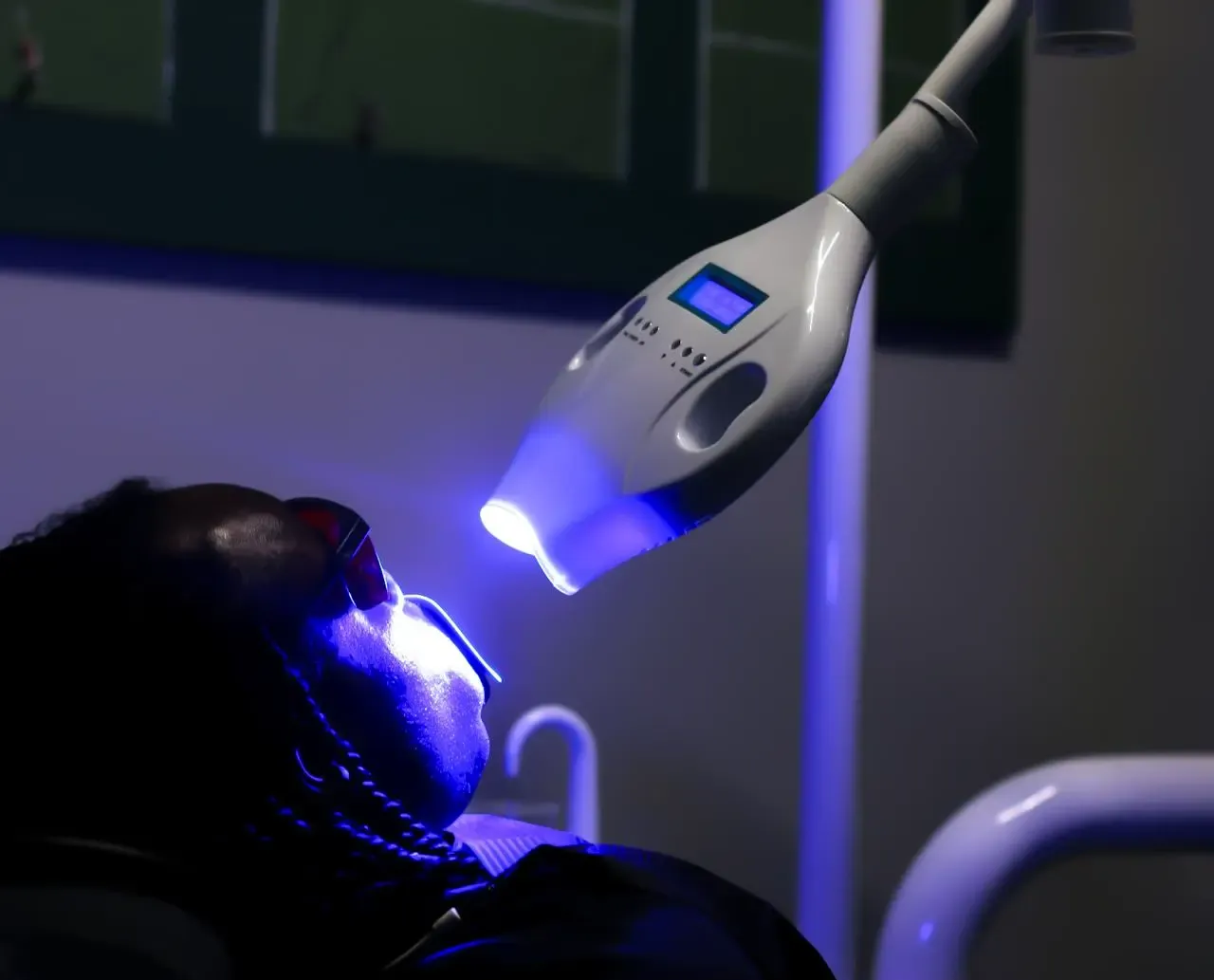 Professional teeth whitening treatment in Albania at ICE ALB Smiles